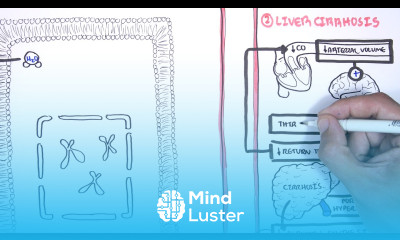 Hyponatraemia Hyponatremia classification causes pathophysiology treatment