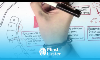 Amoebic dysentery Entamoeba Histolytica