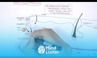 Microbiology Staphylococcus Aureus and Skin Abscess