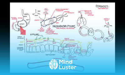 Microbiology Helicobacter Pylori Ulcer
