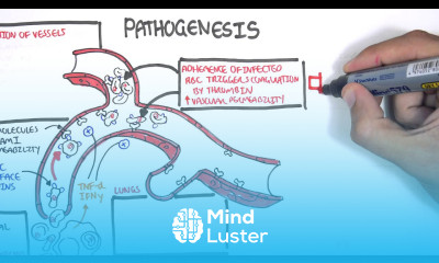 Malaria Pathophysiology