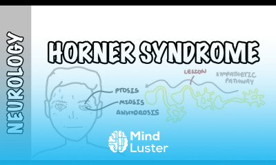 Horner Syndrome anatomy causes pathophysiology investigation