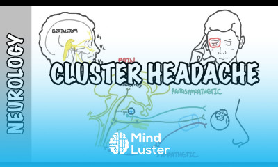 Cluster Headaches symptoms pathophysiology treatment