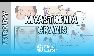 Myasthenia Gravis symptoms pathophysiology investigations treatment