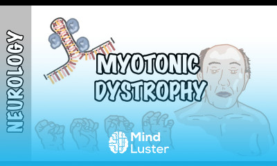 Myotonic Dystrophy signs and symptoms pathophysiology treatment