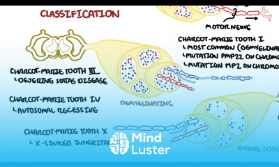 Charcot Marie Tooth Disease