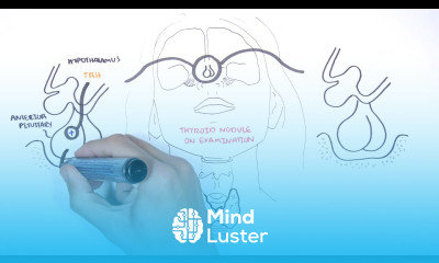 Approach to a Thyroid Nodule causes investigation and treatment