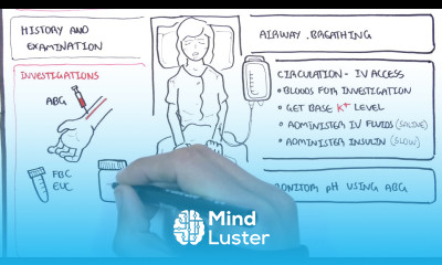 Diabetic Ketoacidosis Diabetes Type I Management Summary