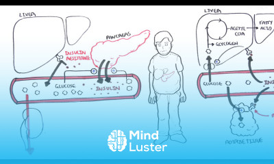 Diabetes Type II Pathophysiology