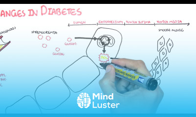 Diabetes Complication and Pathophysiology of the complication