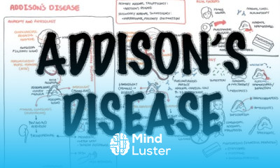 Addison s Disease Overview clinical features pathophysiology investigations treatment