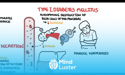 Type I and Type II Diabetes chronic complications and management
