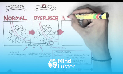 Cancer Introduction II