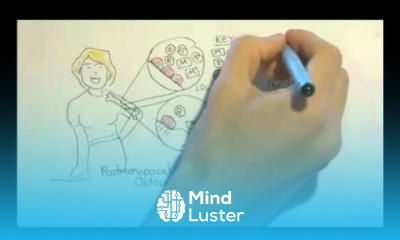 Osteoporosis Part II