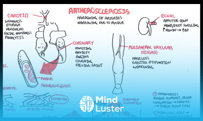 Atherosclerosis Pathophysiology
