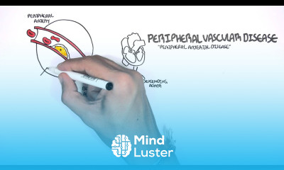 Cardiovascular Disease Overview