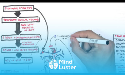 Pulmonary Embolism PART I Overview