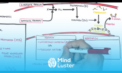 Pulmonary Embolism PART II