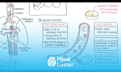 PART II Pneumonia Transmission Causative Agents Investigations Management