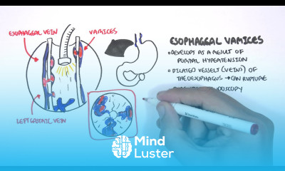 Upper GI Bleed Causes Overview