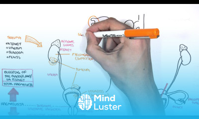 Causes of Haematuria