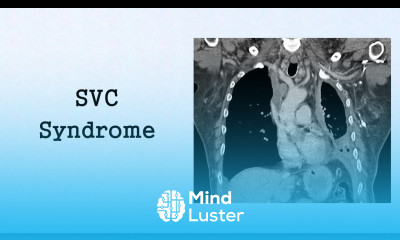 SVC Syndrome Oncologic Emergencies