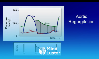 Cardiac Auscultation