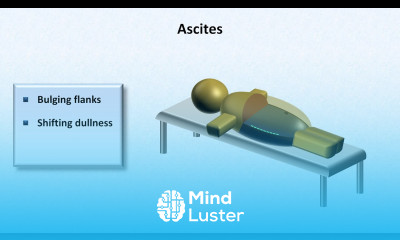 Cirrhosis Physical Findings