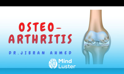 OSTEOARTHRITIS II BONES AND SOFT TISSUE II ARTHRITIS II ROBBINS 10TH E II PATHOLOGY LECTURES