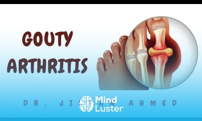 GOUTY ARTHRITIS II BONES AND SOFT TISSUE II ARTHRITIS II ROBBINS 10TH E II PATHOLOGY LECTURES
