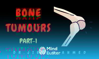 BONE TUMOUR II PART 1 II ROBBINS II SYSTEMIC PATHOLOGY