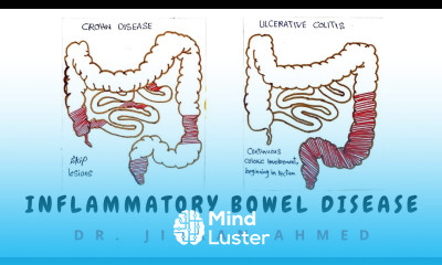 INFLAMMATORY BOWEL DISEASE II GIT II ROBBINS 10TH E II PATHOLOGY LECTURES II DrJIBRANAHMED