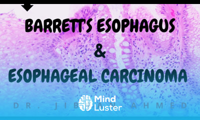 BARRETTS ESOPHAGUS AND ESOPHAGEAL CANCER II GIT II ROBBINS 10TH E II PATHOLOGY LECTURES II