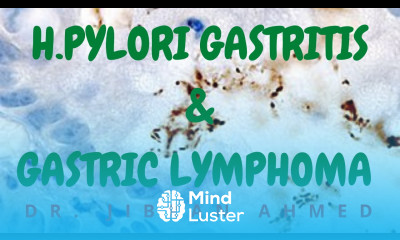 H PYLORI GASTRITIS AND GASTRIC LYMPHOMAII GIT II ROBBINS 10TH E II PATHOLOGY LECTURES II