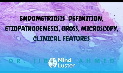 ENDOMETRIOSIS II FEMALE GENITAL TRACT II ROBBINS 10TH E II PATHOLOGY LECTURE