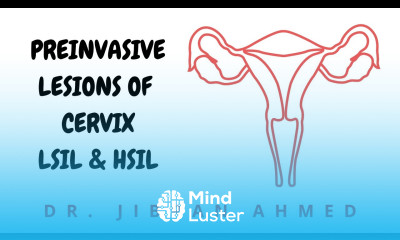 PREINVASIVE CERVICAL LESIONS II LSIL AND HSIL II FGT II ROBBINS 10TH E II PATHOLOGY LECTURES