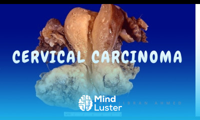 CERVICAL CARCINOMA II FGT II ROBBINS 10TH E II PATHOLOGY LECTURES