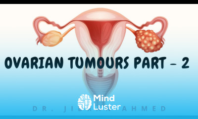 OVARIAN TUMOURS PART 2 II FGT II ROBBINS 10TH E II PATHOLOGY LECTURES II