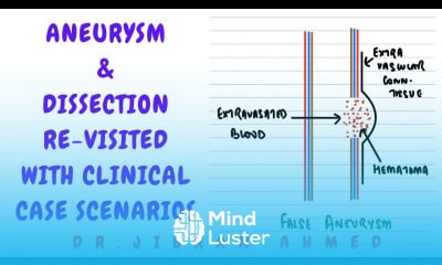 ANEURYSM AND DISSECTION REVISITED II CLINICAL CASE SCENARIOS II NEXT EXAM II ROBBINS