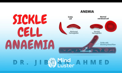 SICKLE CELL ANAEMIA II HEMOLYTIC ANAEMIA II ROBBINS 10TH E II PATHOLOGY LECTURE