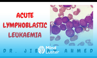 ACUTE LYMPHOBLASTIC LEUKAEMIA LYMPHOMA II HEMATOLOGY II ROBBINS 10TH E II PATHOLOGY LECTURES II