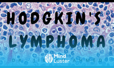 HODGKINS LYMPHOMA II ROBBINS 10TH E II HEMATOLOGY