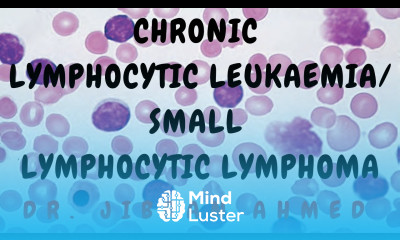 CHRONIC LYMPHOCYTIC LEUKAEMIA II SMALL LYMPHOCYTIC LEUKAEMIA II ROBBINS 10TH E II HEMATOLOGY II