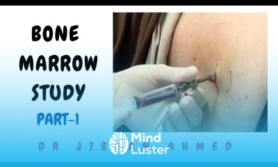 BONE MARROW STUDY II PART 1 II HEMATOLOGY II POST GRADUATE RESIDENCY II MD DNB