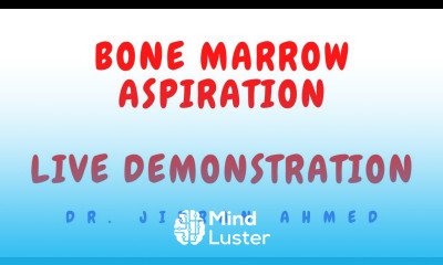 BONE MARROW ASPIRATION II LIVE DEMONSTRATION II HEMATOLOGY II POST GRADUATE RESIDENCY II MD DNB