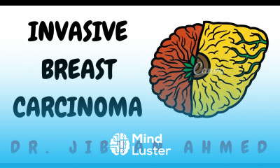INVASIVE BREAST CARCINOMA II POST GRADUATE LEARNING II FLETHCHERS 5TH E II WHO BREAST II