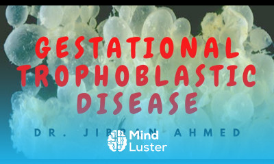 GESTATIONAL TROPHOBLASTIC DISEASEII POST GRADUATE LEARNING II PATHOLOGY LECTURES II DrJIBRANAHMED