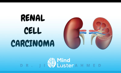 RENAL CELL CARCINOMA II ROBBINS 10TH E II KIDNEY II PATHOLOGY LECTURES