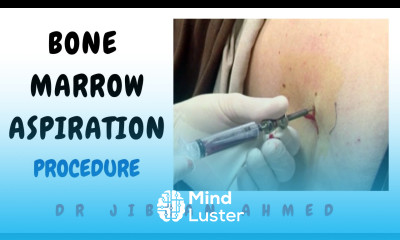 BONE MARROW ASPIRATION II LIVE DEMONSTRATION II HEMATOLOGY II POST GRADUATE RESIDENCY II MD DNB