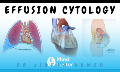 EFFUSION CYTOLOGY II NON NEOPLASTIC CONDITIONS II POST GRADUATE LEARNING II II DR JIBRAN AHMED